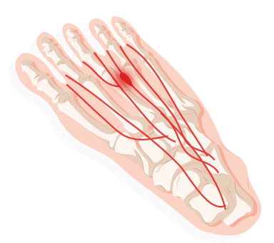 Foot Diagnosis Chart