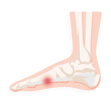 Foot Ailment Chart