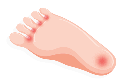 Identifying Your Foot Pain 21 Treadmillreviews Net Identifying Your Foot Pain 21 Treadmillreviews Net